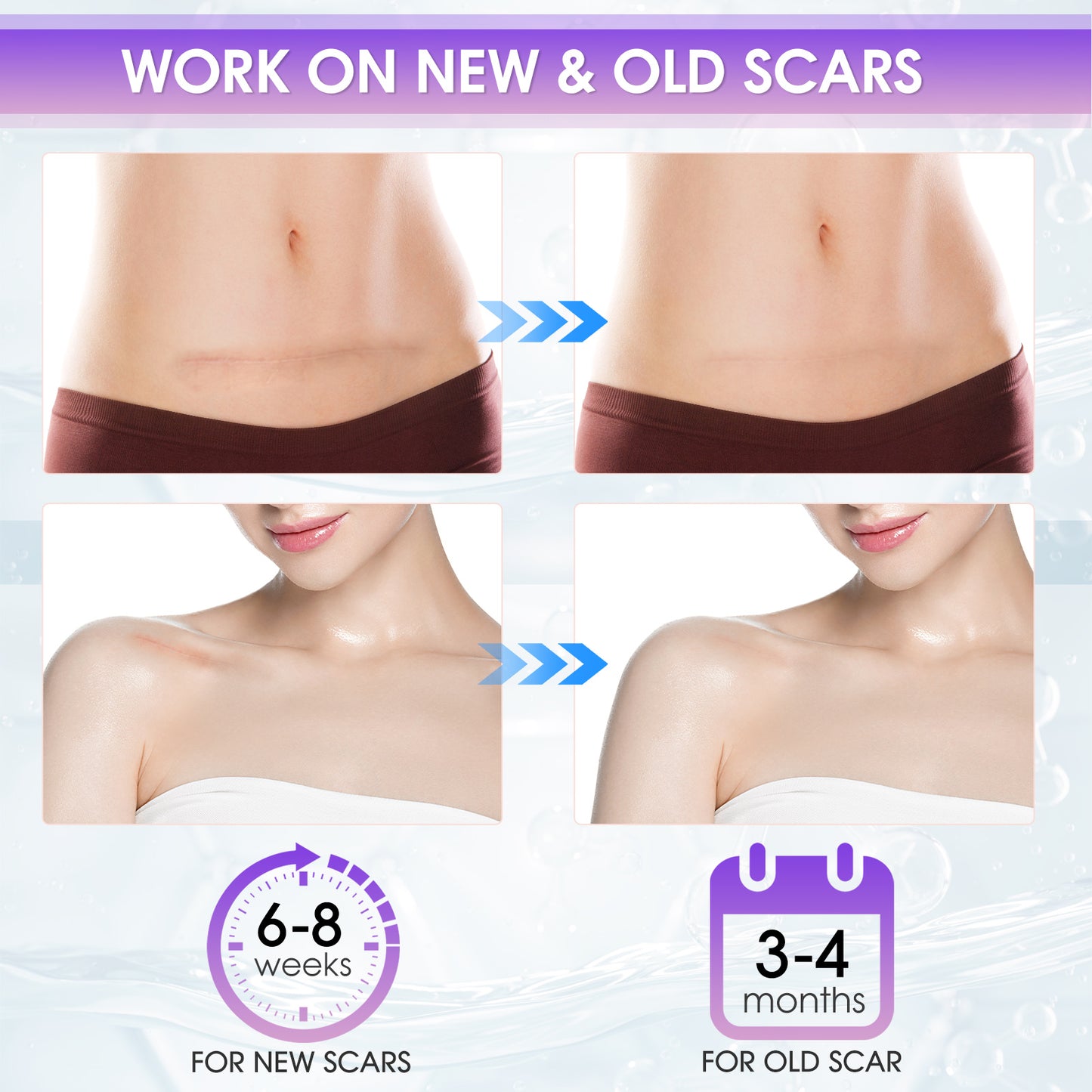 Silicone Scar Gel - 2OZ