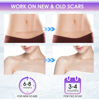 Silicone Scar Gel - 2OZ